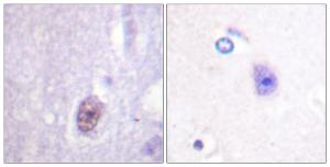 Immunohistochemical analysis of paraffin-embedded human brain using Anti-SP1 (phospho Thr453) Antibody. The right hand panel represents a negative control, where the antibody was pre-incubated with the immunising peptide.