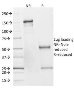 SDS-PAGE analysis of Anti-SDHB Antibody [SDHB/2382] under non-reduced and reduced conditions; showing intact IgG and intact heavy and light chains, respectively. SDS-PAGE analysis confirms the integrity and purity of the antibody.