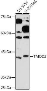 Western blot analysis of extracts of various cell lines, using Anti-Tropomodulin 2 Antibody [ARC2318] (A306934) at 1:1,000 dilution