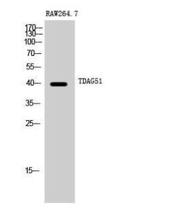 Anti-PHLA1 antibody