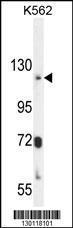 Anti-ATP8A2 Rabbit Polyclonal Antibody (Biotin)