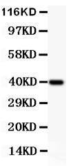 Anti-IKK Alpha Polyclonal Antibody