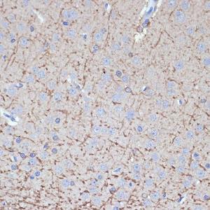 Immunohistochemistry analysis of paraffin-embedded rat brain using Anti-Tropomodulin 2 Antibody [ARC2318] (A306934) at a dilution of 1:100 (40X lens). Perform microwave antigen retrieval with 10 mM Tris/EDTA buffer pH 9.0 before commencing with IHC staining protocol