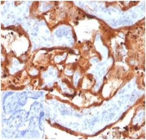 Immunohistochemical analysis of formalin-fixed, paraffin-embedded human placenta tissue using Anti-Transglutaminase II Antibody [TGM2/3612]. Inset: PBS instead of the primary antibody. Secondary antibody negative control.