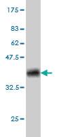 Anti-CDKL1 Mouse Monoclonal Antibody [clone: 5B11]