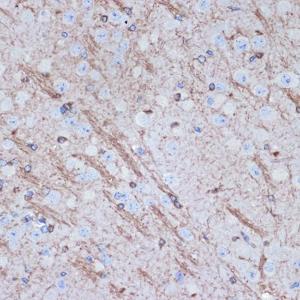 Immunohistochemistry analysis of paraffin-embedded mouse brain using Anti-Tropomodulin 2 Antibody [ARC2318] (A306934) at a dilution of 1:100 (40X lens). Perform microwave antigen retrieval with 10 mM Tris/EDTA buffer pH 9.0 before commencing with IHC staining protocol