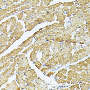 Immunohistochemistry analysis of paraffin-embedded mouse heart using Anti-Complex IV Antibody (A308092) at a dilution of 1:100 (40x lens). Perform microwave antigen retrieval with 10 mM PBS buffer pH 7.2 before commencing with IHC staining protocol.