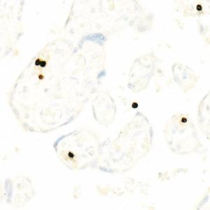 Anti-CD66b Rabbit Monoclonal Antibody [clone: ARC57403]