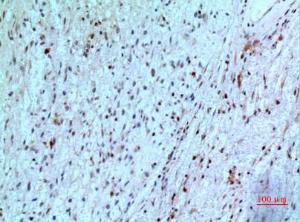 Immunohistochemical analysis of paraffin-embedded human brain using Anti-TYMP Antibody