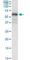 Anti-MAGEA8 Polyclonal Antibody Pair