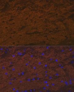 Immunofluorescence analysis of rat brain cells using Anti-Tropomodulin 2 Antibody [ARC2318] (A306934) at a dilution of 1:100 (40X lens). DAPI was used to stain the cell nuclei (blue)