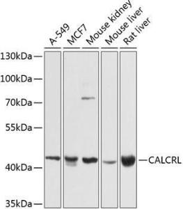 Western blot analysis of extracts of various cell lines, using Anti-CRLR Antibody (A12274) at 1:1,000 dilution