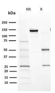 Anti-Cytochrome P450 1A1 + 1A2 Mouse Monoclonal Antibody [clone: MC1]