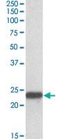 Anti-SOD2 Goat Polyclonal Antibody