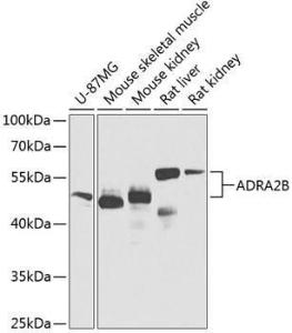 Western blot analysis of extracts of various cell lines, using Anti-ADRA2B Antibody (A12275) at 1:1,000 dilution