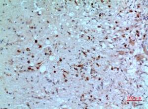 Immunohistochemical analysis of paraffin-embedded human brain using Anti-TYMP Antibody