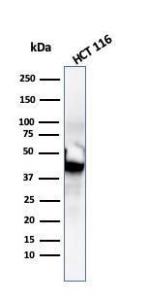 Western blot analysis of HCT116 cell lysate using Anti-Cytokeratin 8 Antibody [SPM192]