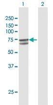 Anti-P4HTM Rabbit Polyclonal Antibody