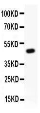 Anti-Kv2.1 Polyclonal Antibody