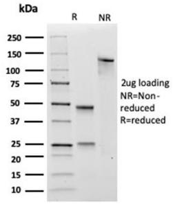 SDS-PAGE analysis of Anti-Transglutaminase II Antibody [TGM2/3612] under non-reduced and reduced conditions; showing intact IgG and intact heavy and light chains, respectively. SDS-PAGE analysis confirms the integrity and purity of the antibody.