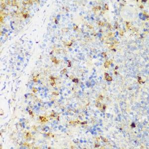 Immunohistochemistry analysis of paraffin-embedded mouse spleen using Anti-FNDC4 Antibody (A305638) at a dilution of 1:150 (40X lens)