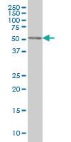 Anti-CDK8 Mouse Monoclonal Antibody [clone: 2E6]