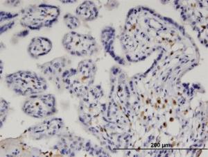 Anti-IRF5 Mouse Monoclonal Antibody [clone: 2G9]