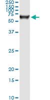 Anti-STK33 Mouse Monoclonal Antibody [clone: 4A12]