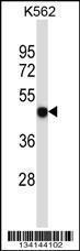 Anti-P2RX5 Rabbit Polyclonal Antibody (AP (Alkaline Phosphatase))