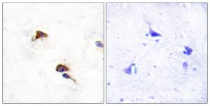 Immunohistochemical analysis of paraffin-embedded human brain tissue using Anti-PPIF Antibody. The right hand panel represents a negative control, where the antibody was pre-incubated with the immunising peptide