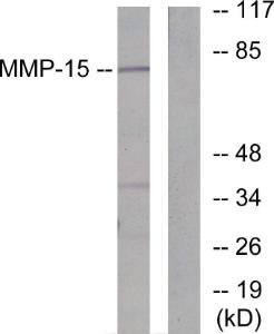 Western blot analysis of lysates from MDA-MB-435 cells using Anti-MMP-15 Antibody. The right hand lane represents a negative control, where the antibody is blocked by the immunising peptide.