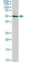 Anti-CDK8 Mouse Monoclonal Antibody [clone: 2E6]