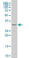 Anti-YBX3 Mouse Monoclonal Antibody [clone: 1H5]