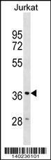 Anti-HMOX2 Rabbit Polyclonal Antibody (Biotin)