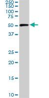 Anti-CDK8 Mouse Monoclonal Antibody [clone: 2E6]