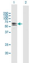 Anti-PKNOX1 Mouse Polyclonal Antibody