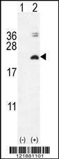 Anti-IL17F Rabbit Polyclonal Antibody (PE (Phycoerythrin))