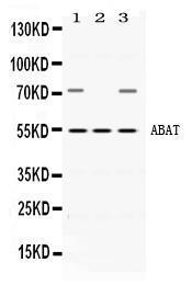 Anti-ABAT Rabbit Polyclonal Antibody