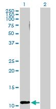 Anti-RRN3 Mouse Polyclonal Antibody