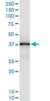 Anti-GOT1 Polyclonal Antibody Pair