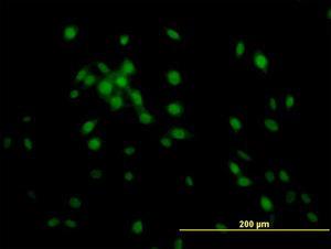 Anti-KLF11 Mouse Monoclonal Antibody [clone: 10D8]