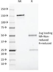 SDS-PAGE analysis of Anti-CD19 Antibody [CVID3/429] under non-reduced and reduced conditions; showing intact IgG and intact heavy and light chains, respectively. SDS-PAGE analysis confirms the integrity and purity of the Antibody