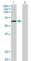 Anti-PKNOX1 Rabbit Polyclonal Antibody