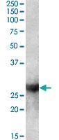 Anti-LGALS3 Goat Polyclonal Antibody