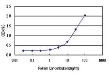 Anti-MAGEA9 Antibody Pair