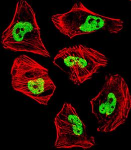 Anti-TARDBP Rabbit Polyclonal Antibody (FITC (Fluorescein Isothiocyanate))