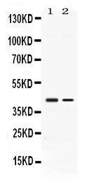 Anti-ABHD5 Rabbit Polyclonal Antibody