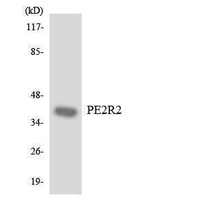 Western blot analysis of the lysates from 293 cells using Anti-PE2R2 Antibody