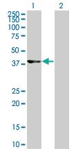 Anti-CDK9 Mouse Monoclonal Antibody [clone: 2D7]