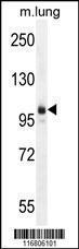 Anti-AEBP1 Rabbit Polyclonal Antibody (APC (Allophycocyanin))